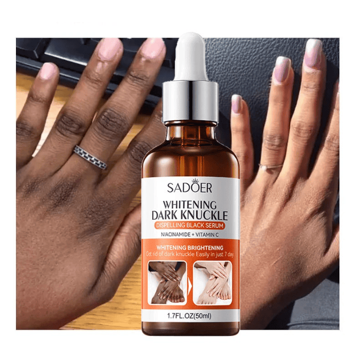 Sadoer Dark Knuckle Whitening Serum